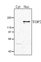 Western blot detection using anti-TOP2 antibodies